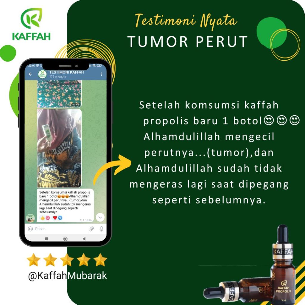 Tumor Perut